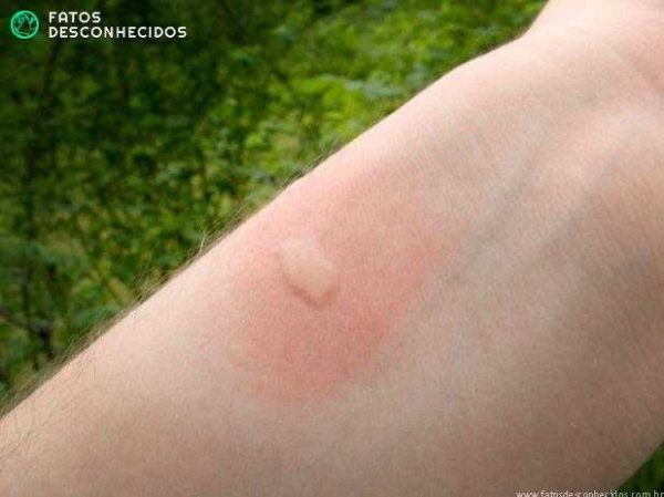 mosquito