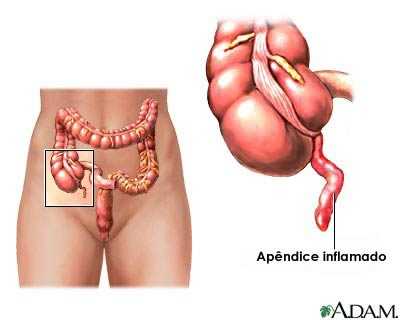 apendice