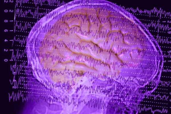 1010-brain-waves-630x420