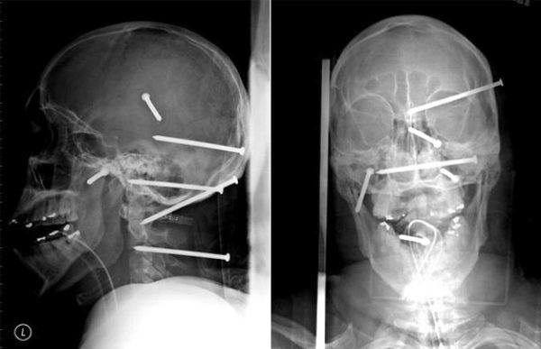 amazing-x-rays