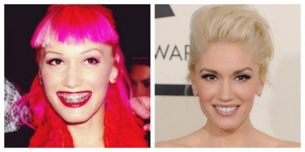 Gwen-Stefani