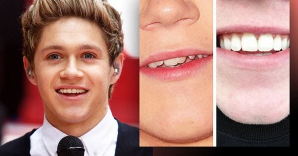 Niall-Horan