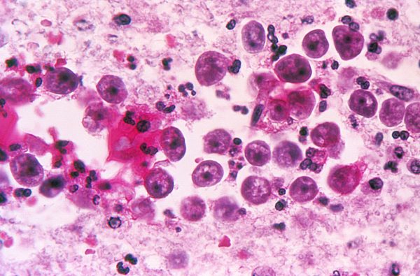 o-NAEGLERIA-FOWLERI-facebook
