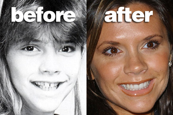 teeth_posh