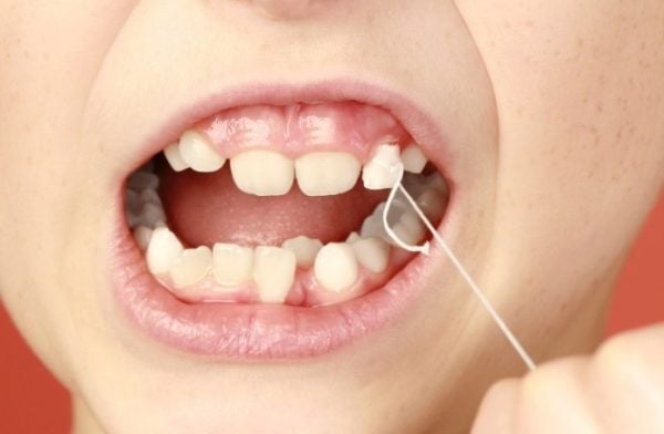 dente-de-leite