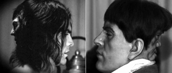 LEFT: Wes Bentley as Edward Mordrake, RIGHT: Wax recreation of the real Edward Mordake