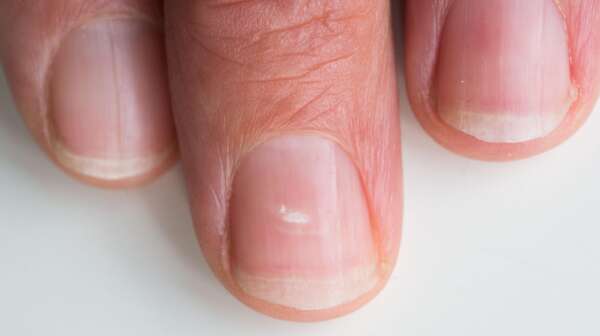 Unhas